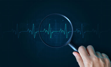 WordPressのHeartbeat APIとは